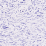 Tissue-Tek Genie® anti-STAT6 - Additional Image 3