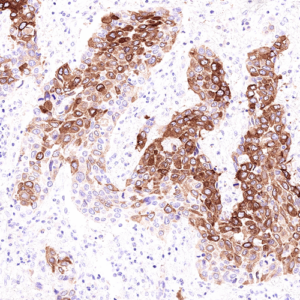 Tissue-Tek Genie&reg; anti-Uroplakin II