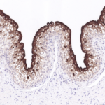 Tissue-Tek Genie® anti-Uroplakin II - Additional Image 1