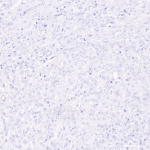 Tissue-Tek Genie® anti-Uroplakin II - Additional Image 2